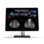 Monitor de grado médico de 12MP, para especialidades como: mamografía, PACS, RAYOS X