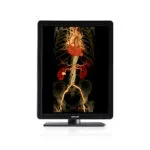 Monitor de grado médico de 3MP