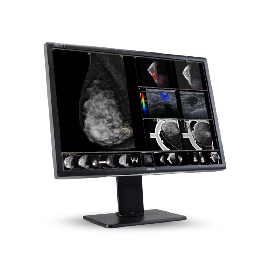 Monitor Nio Color 12MP, ideal para especialidades como mamografía y radiología