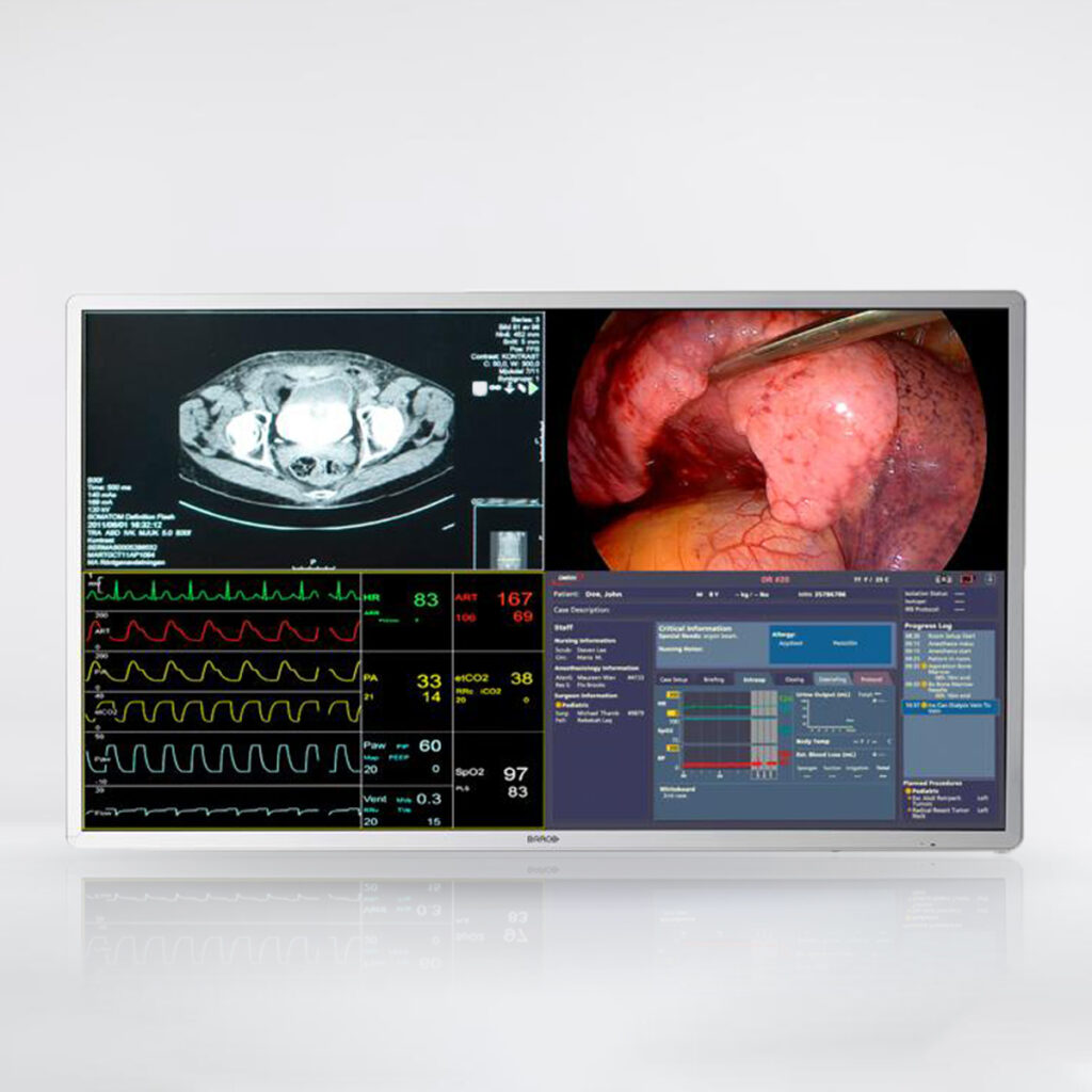 Monitor Quirúrgico MDSC-8255