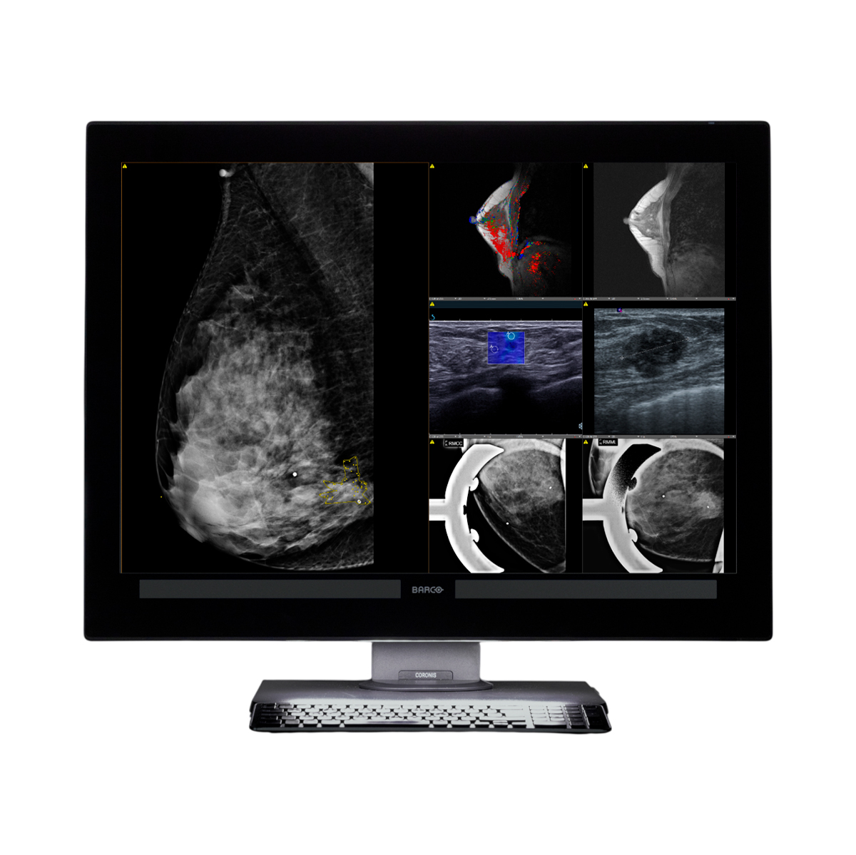 Coronis-OneLook-frontal-on-empty-desk-933-Photoroom