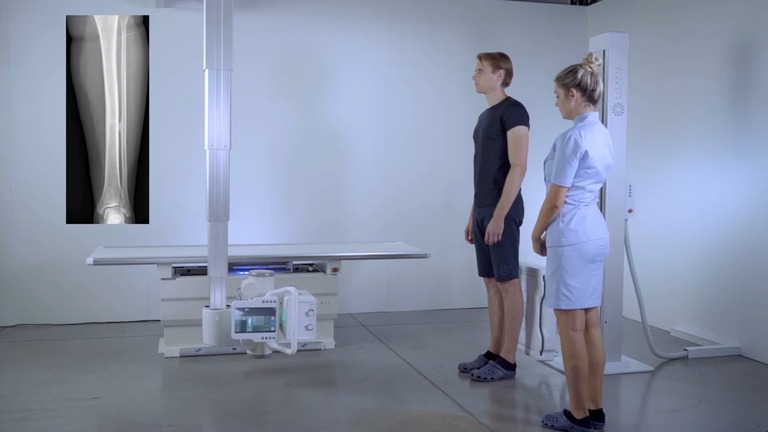 Estudio radiográfico de pie con sistema Visaris Vision C