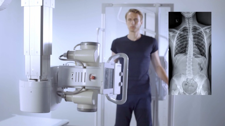 Sistema Visaris Vision C para radiografía de columna