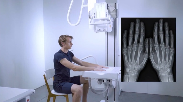 Sistema Visaris Vision C para radiografía de extremidades