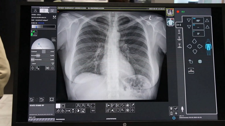 Visualización de radiografía de tórax en sistema Visaris Vision C